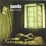 Suede - Dog Man Star