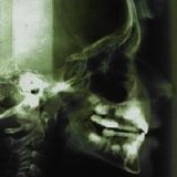 Apulanta - Aivan kuin kaikki muutkin
