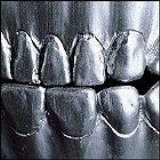 Change Of Heart - Steel Teeth (Promo)