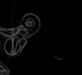 DONEDA Michel - from between