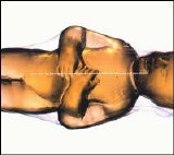 Berne Tim - Open, Coma