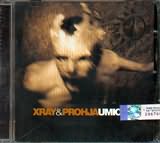X-Ray Feat. Prohja - Umicah
