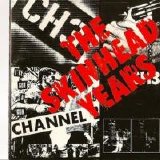 CH3 - The Skinhead Years