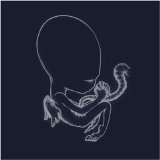 Sigur RÃ³s - ÃgÃ¦tus Byrjun