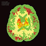 Minus 5, The - Stroke Manor