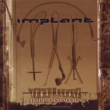 Implant - The Surgical Files